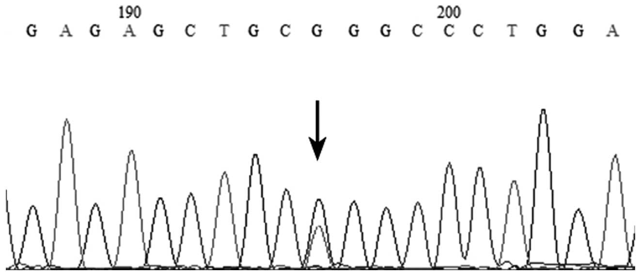 SNPs in the aryl hydrocarbon receptor-interacting protein gene ...