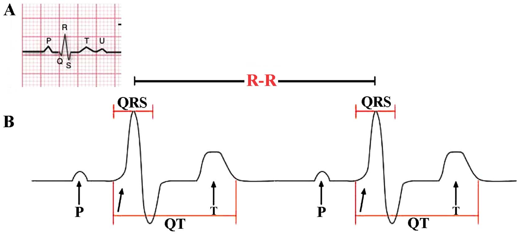 The Role Of Heart Rate Variability In Sports Physiology Review 