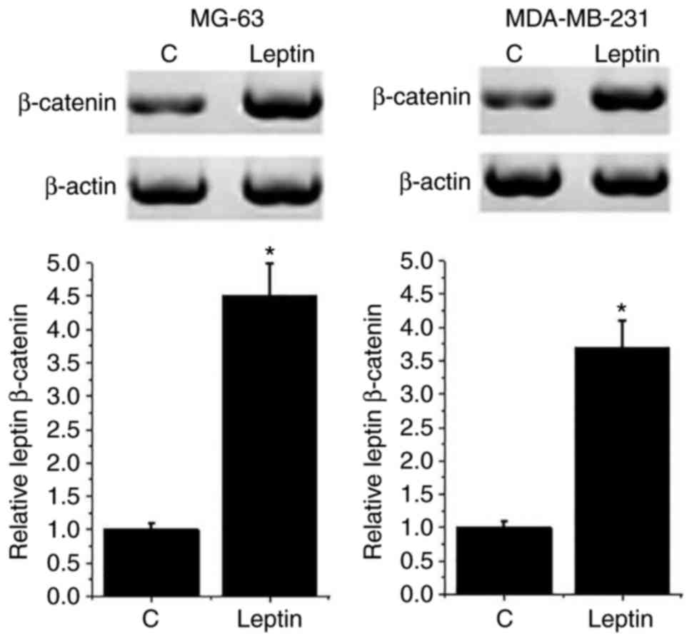 Leptin Promotes The Growth Of Breast Cancer By Upregulating The Wnt B Catenin Pathway
