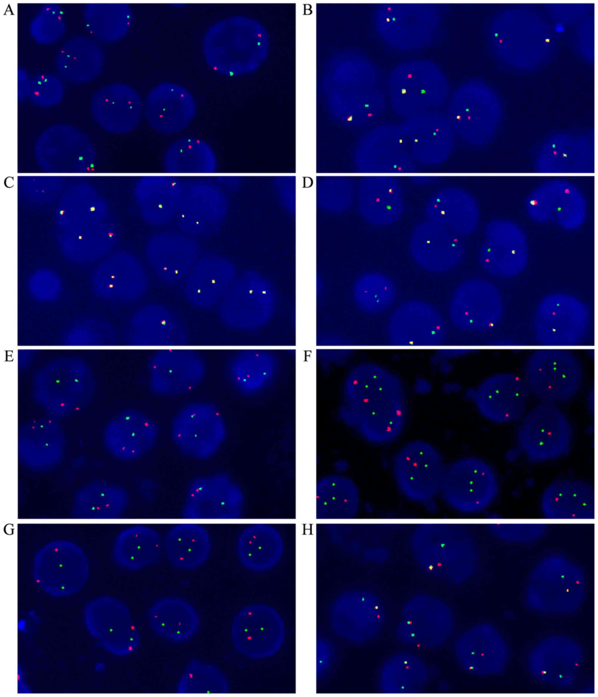 fluorescence in situ hybridization down syndrome