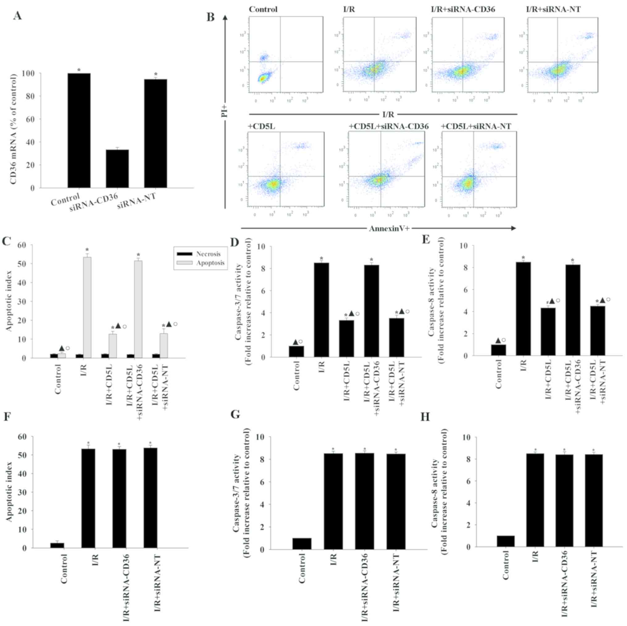 Cd5l Induced Activation Of Autophagy Is Associated With Hepatoprotection In Ischemic Reperfusion Injury Via The Cd36 Atg7 Axis