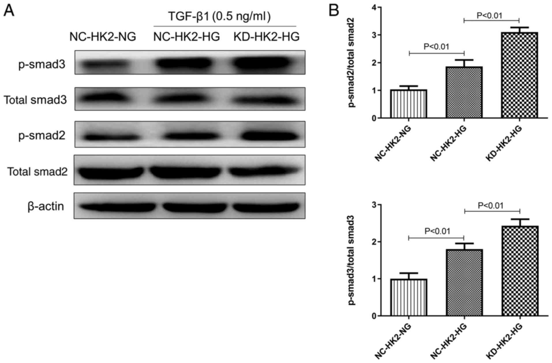 Knockout Of Ngal Aggravates Tubulointerstitial Injury In A Mouse Model Of Diabetic Nephropathy By Enhancing Oxidative Stress And Fibrosis