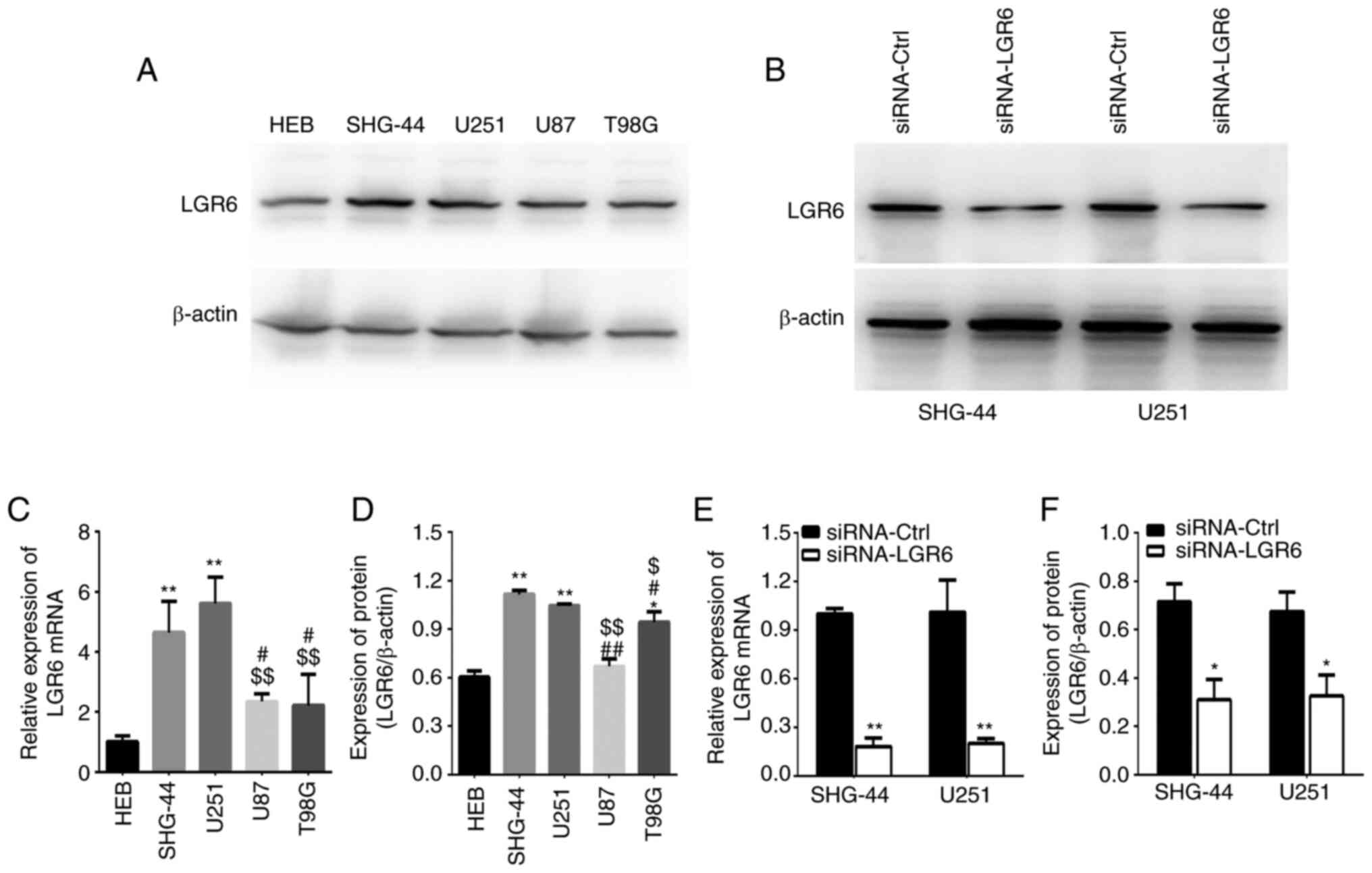 LGR6 promotes glioblastoma malignancy and chemoresistance by 