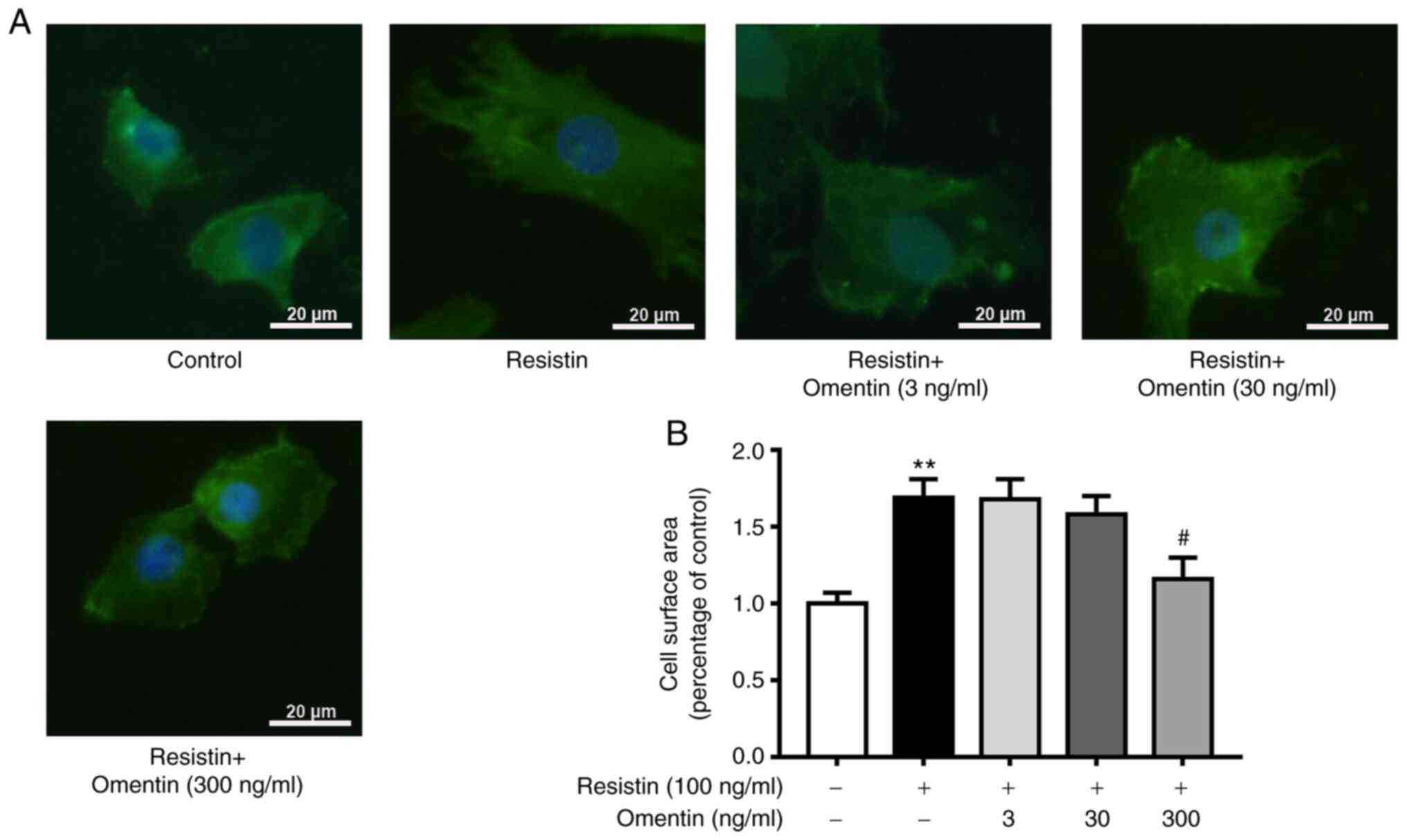 Omentin inhibits the resistin‑induced hypertrophy of H9c2 