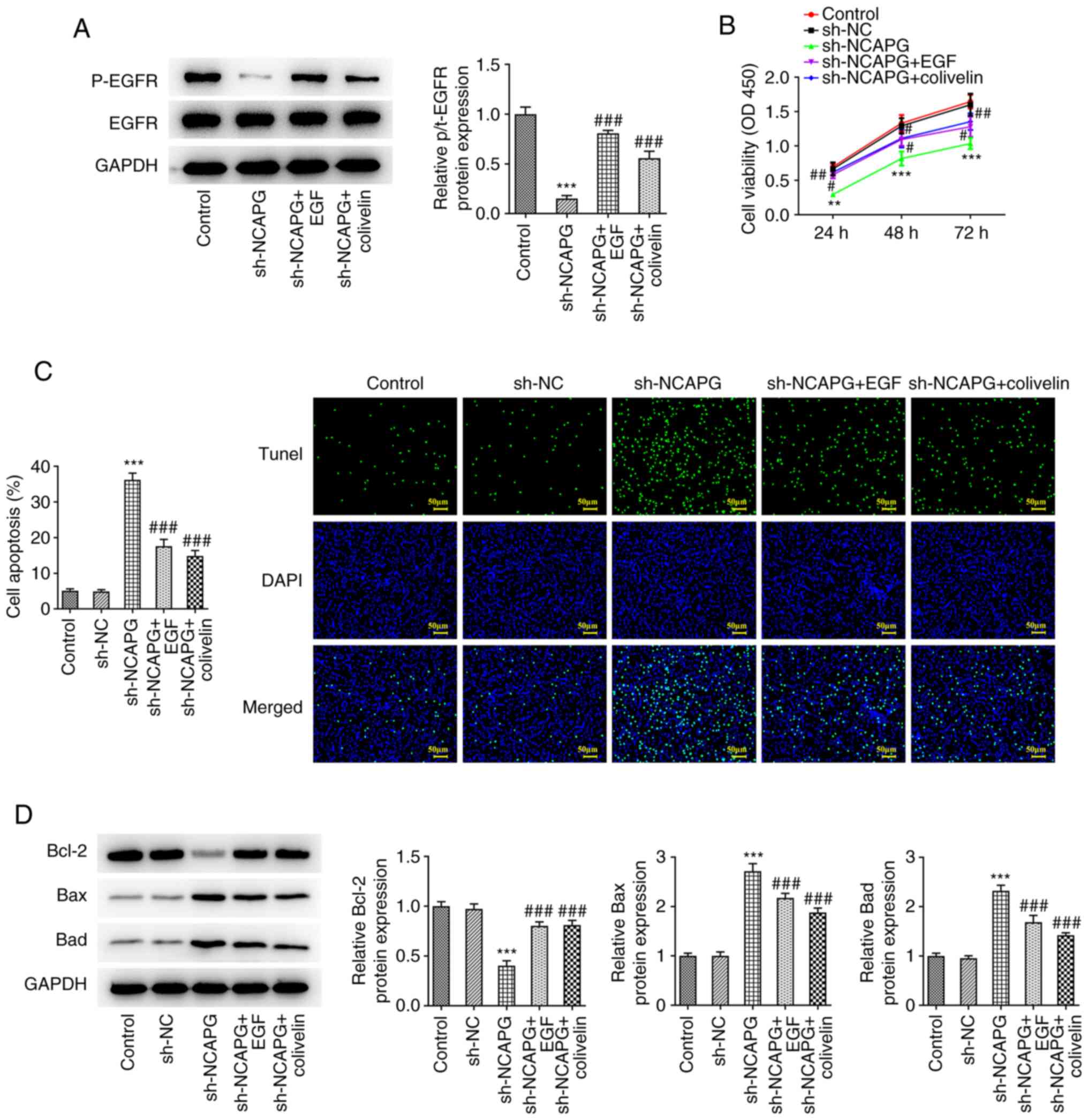Knockdown of NCAPG promotes the apoptosis and inhibits the invasion and ...