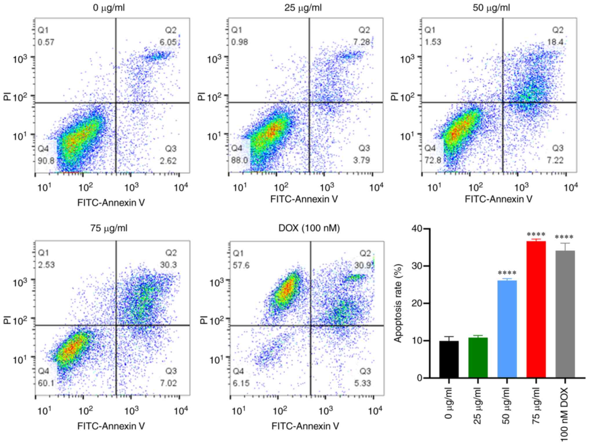 Natural product procyanidin B1 as an antitumor drug for effective ...