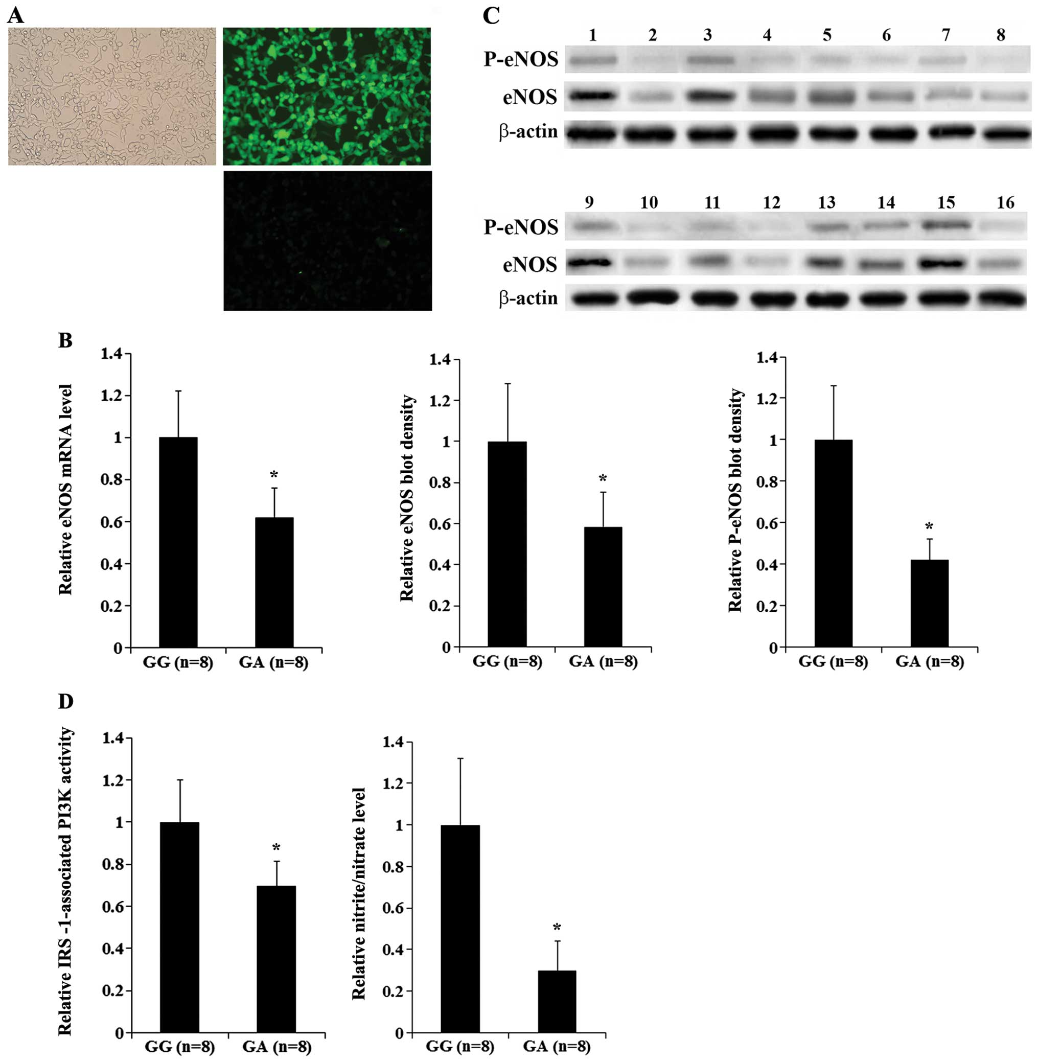 Insulin-Dependent Activation of Endothelial Nitric Oxide Synthase