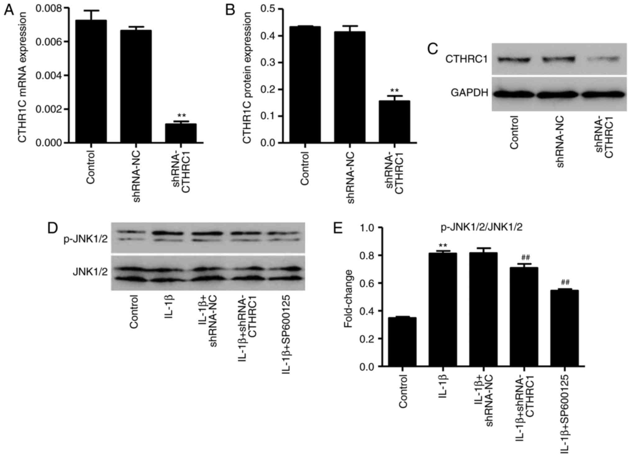 Cthrc1 Mediates Il‑1β‑induced Apoptosis In Chondrocytes Via Jnk1 2 Signaling
