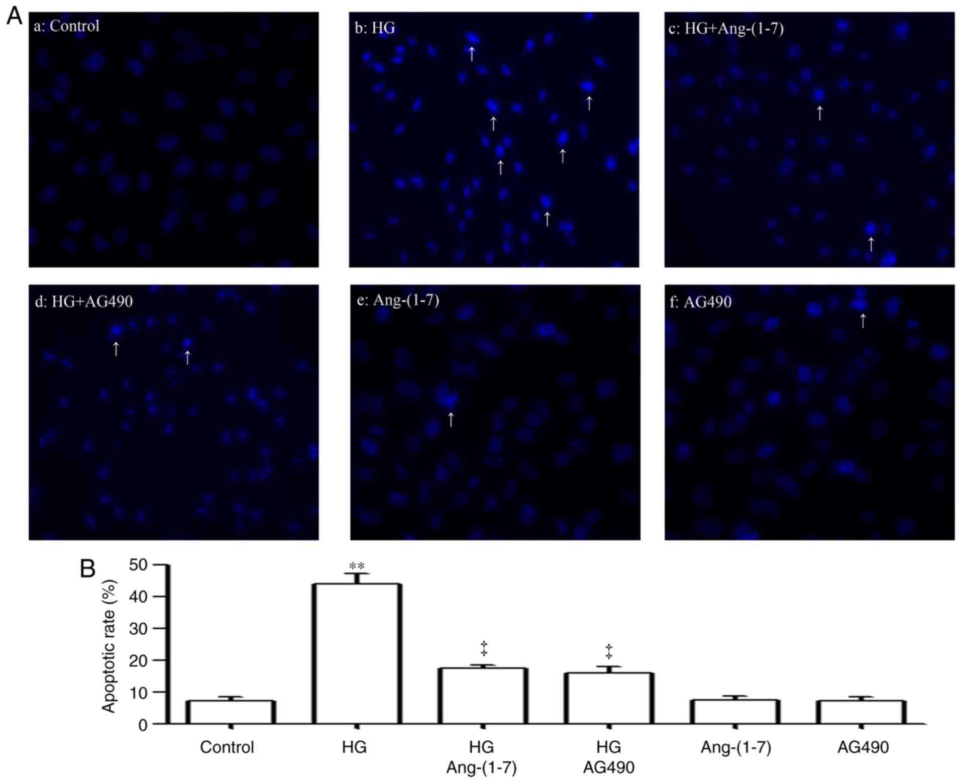 Ang-(1-7) protects HUVECs from high glucose-induced injury and ...
