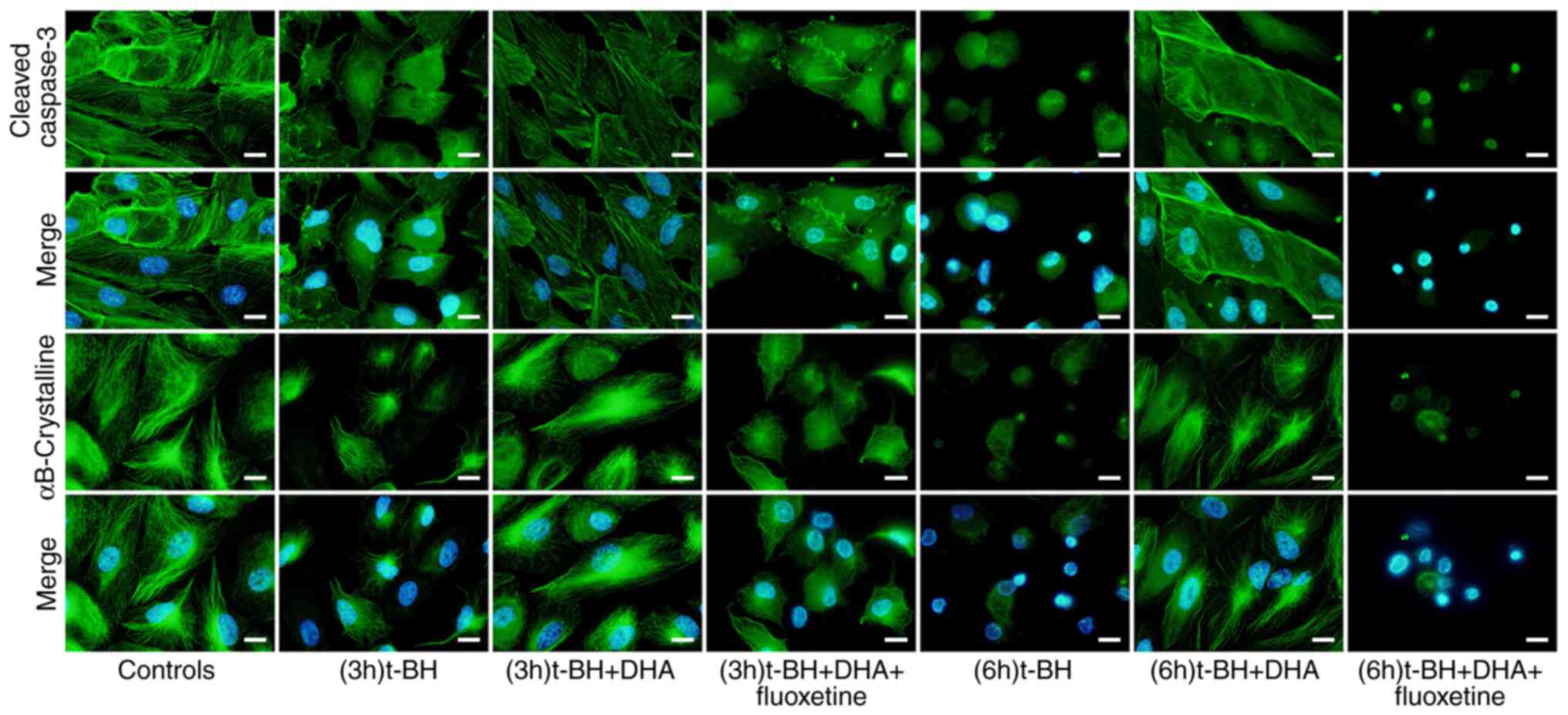 Trek Traak Two Pore Domain Potassium Channels Protect Human Retinal Pigment Epithelium Cells From Oxidative Stress