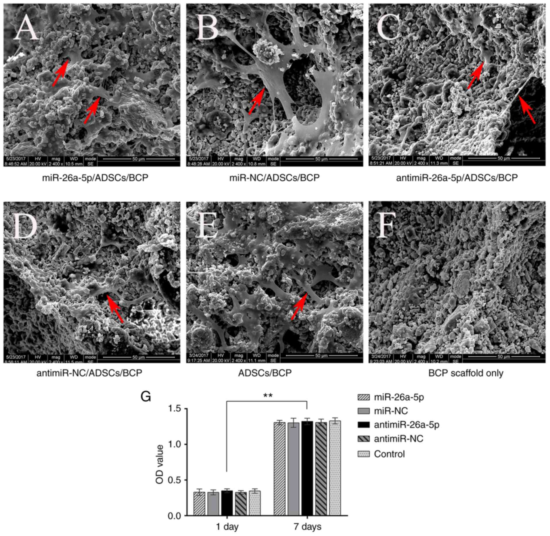The Role Of Antimir 26a 5p Biphasic Calcium Phosphate In Repairing Rat Femoral Defects