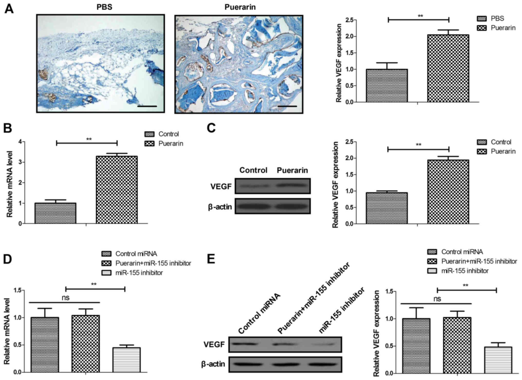 Puerarin Improves Graft Bone Defect Through Microrna 155 3p Mediated P53 Tnf A Stat1 Signaling Pathway