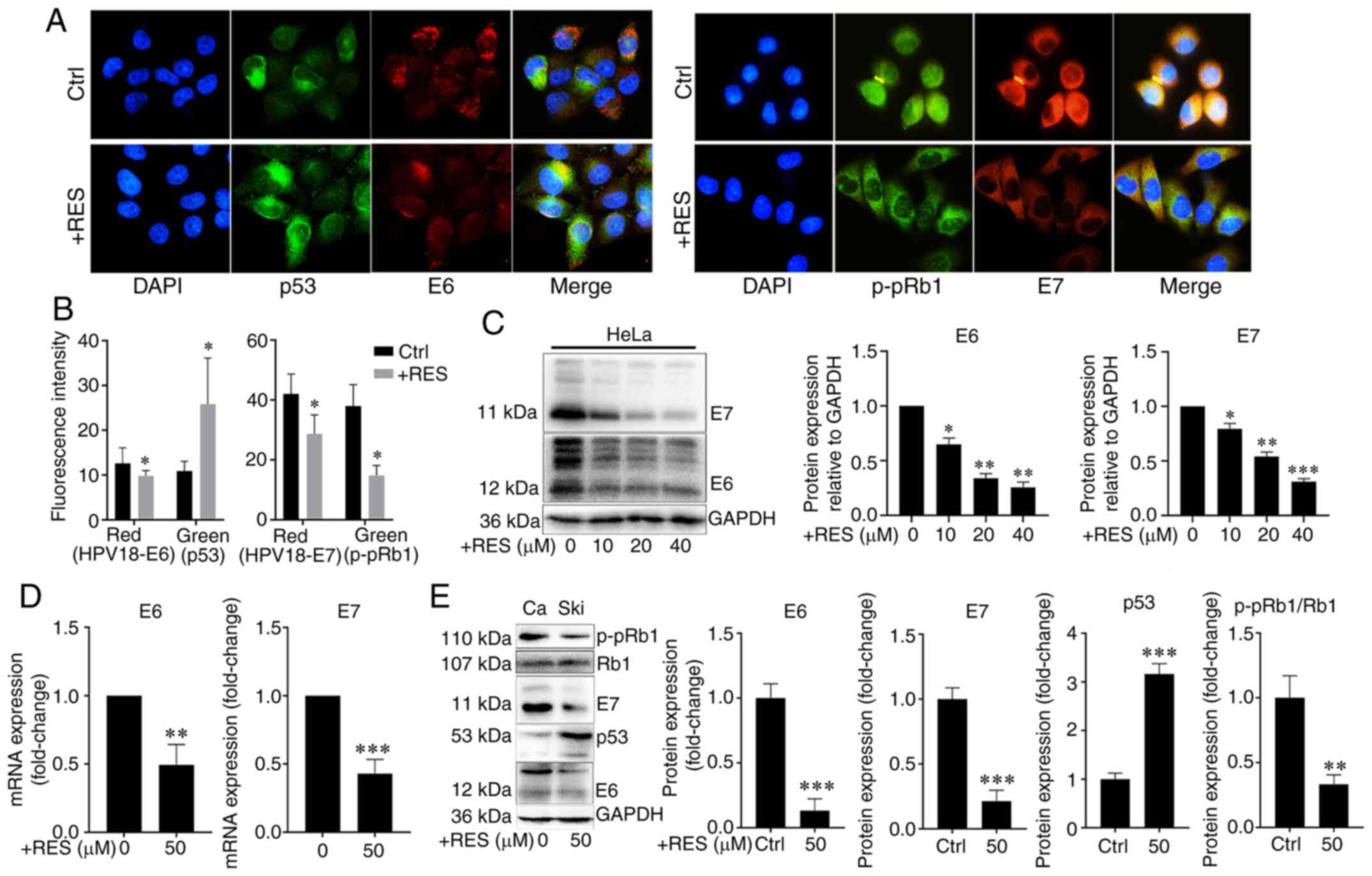 Resveratrol Inhibits The Progression Of Cervical Cancer By Suppressing 