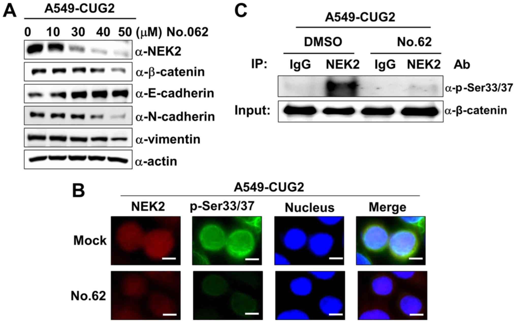 Cgk062 A Small Chemical Molecule Inhibits Cancer Upregulated Gene 2 Induced Oncogenesis Through Nek2 And B Catenin