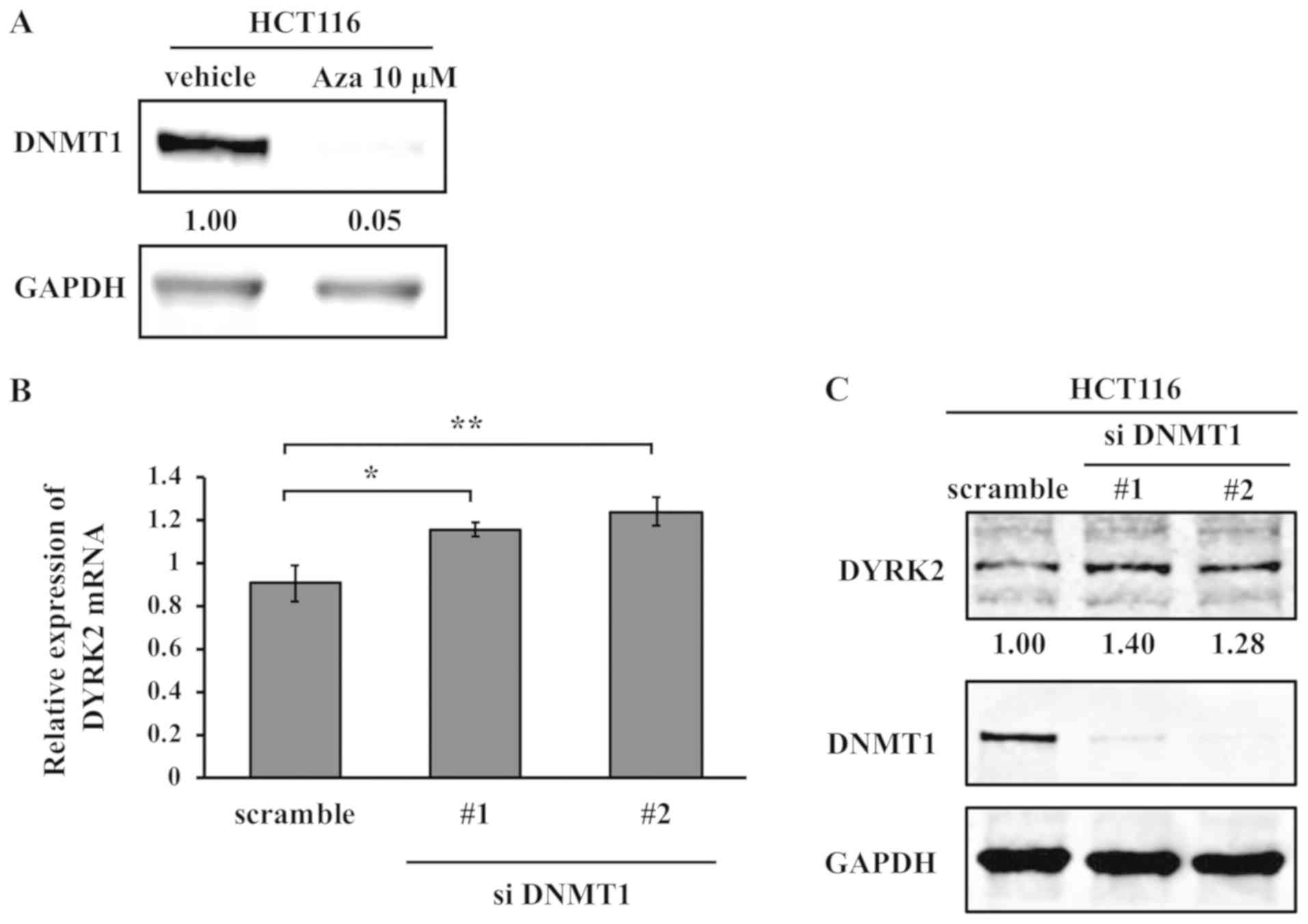 Impairment Of DYRK2 By DNMT1‑mediated Transcription Augments ...