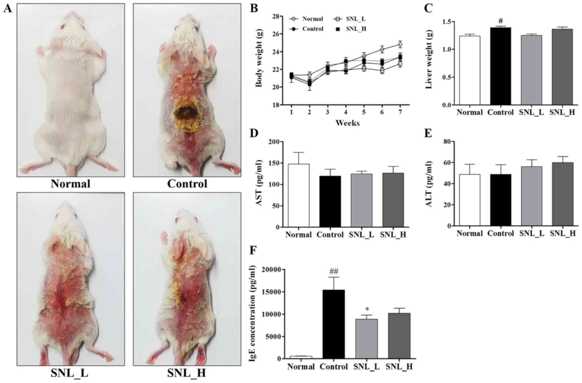 Solanum Nigrum Linne Improves Dncb‑induced Atopic Dermatitis‑like Skin Disease In Balb C Mice