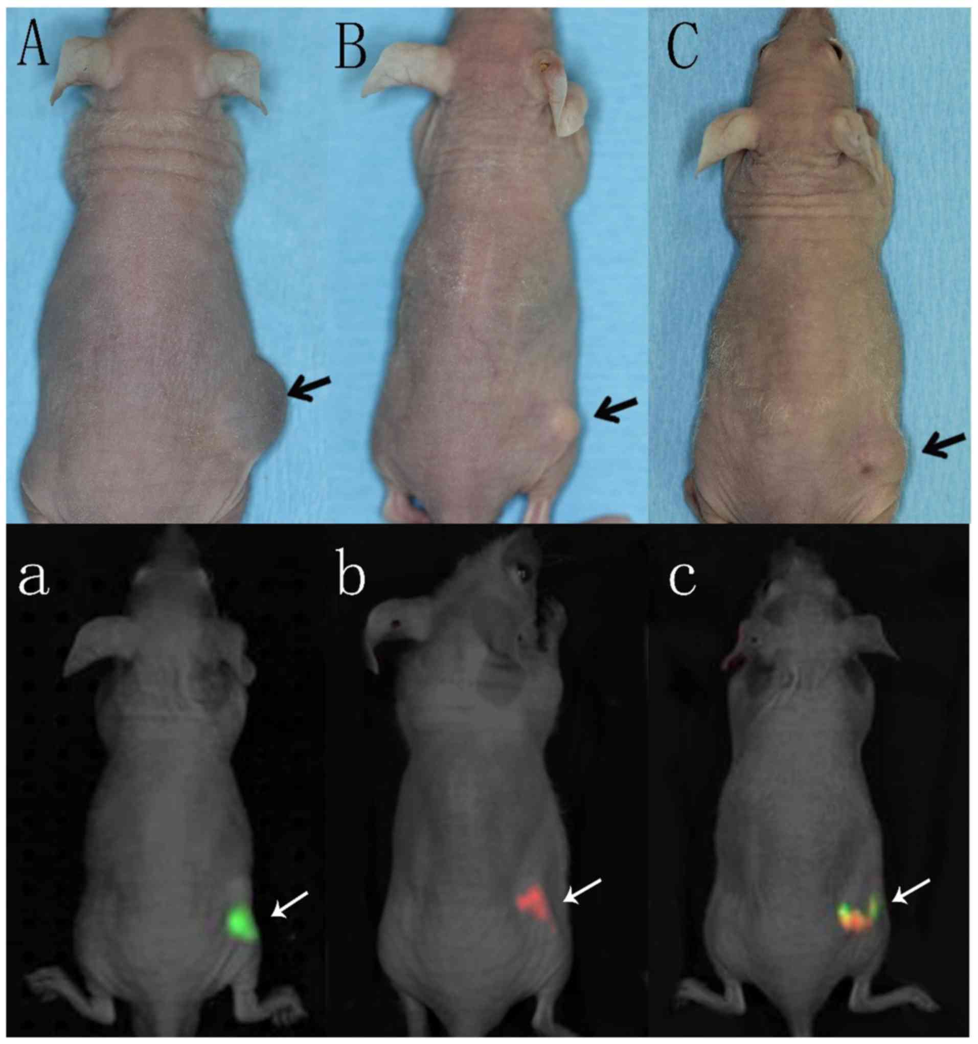 Differences Between Epithelial And Mesenchymal Human Tongue Cancer Cell