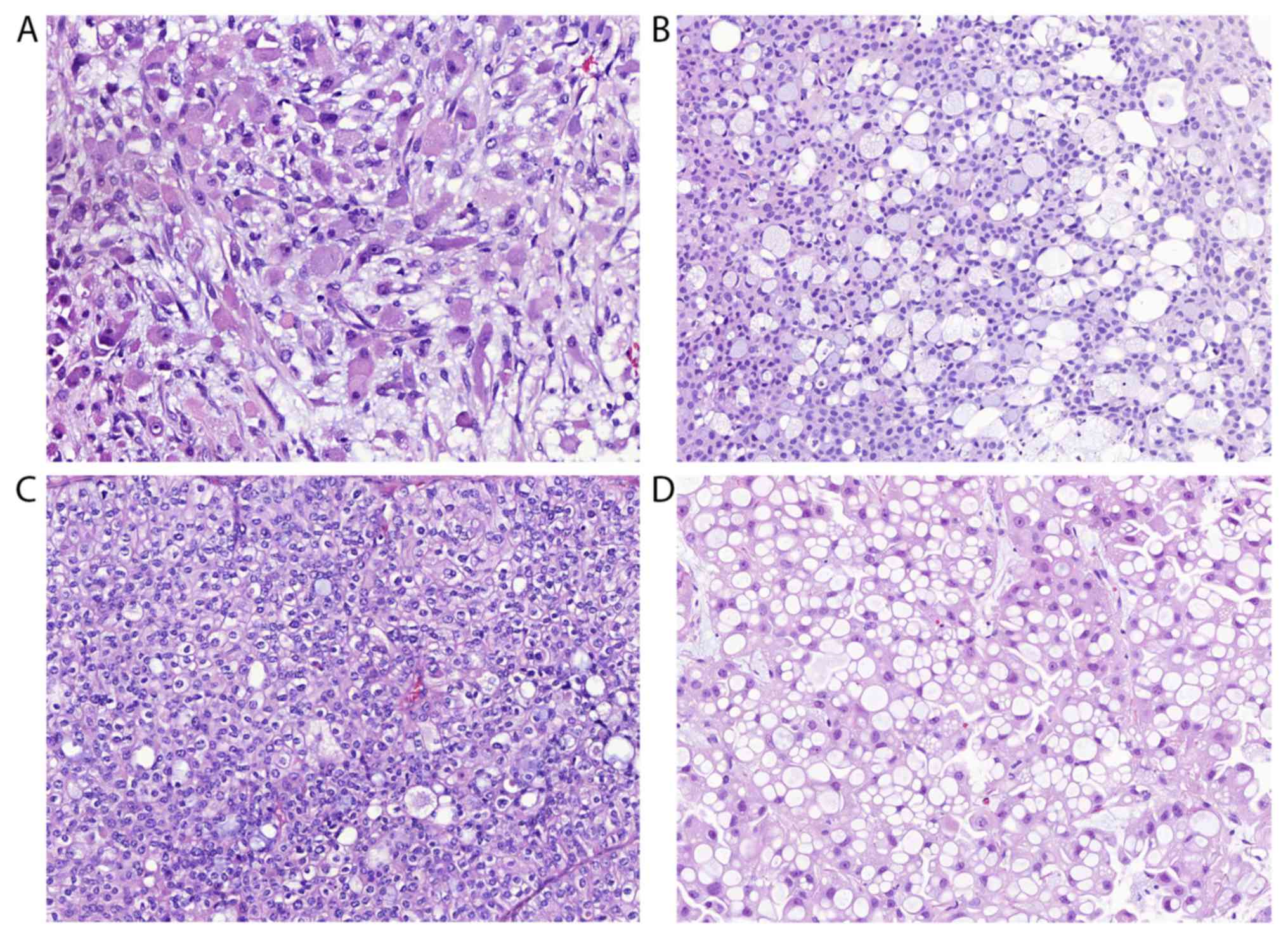 The Dog As An Animal Model For Bladder And Urethral Urothelial 