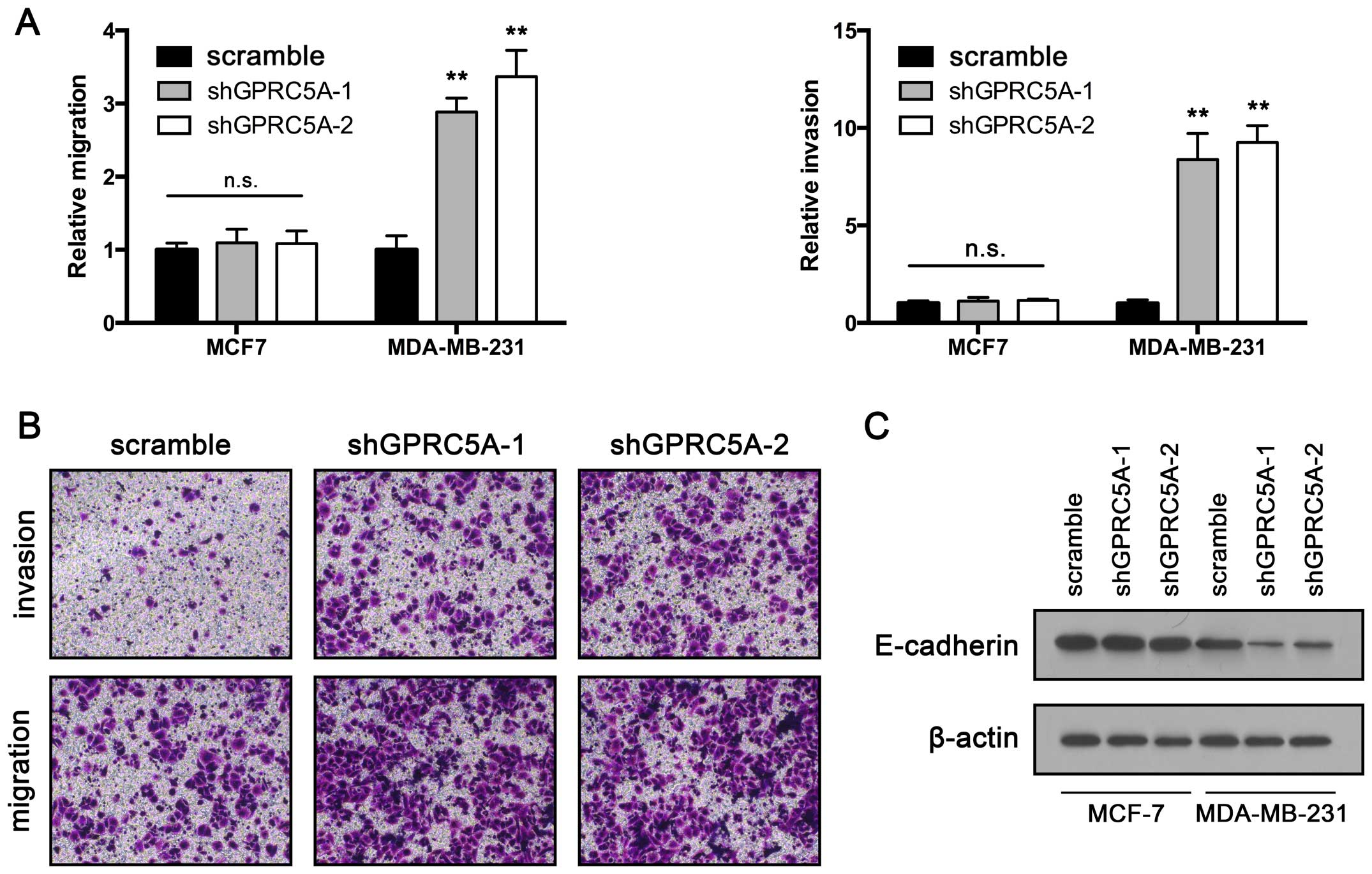 Gprc5a Exerts Its Tumor Suppressive Effects In Breast Cancer Cells By