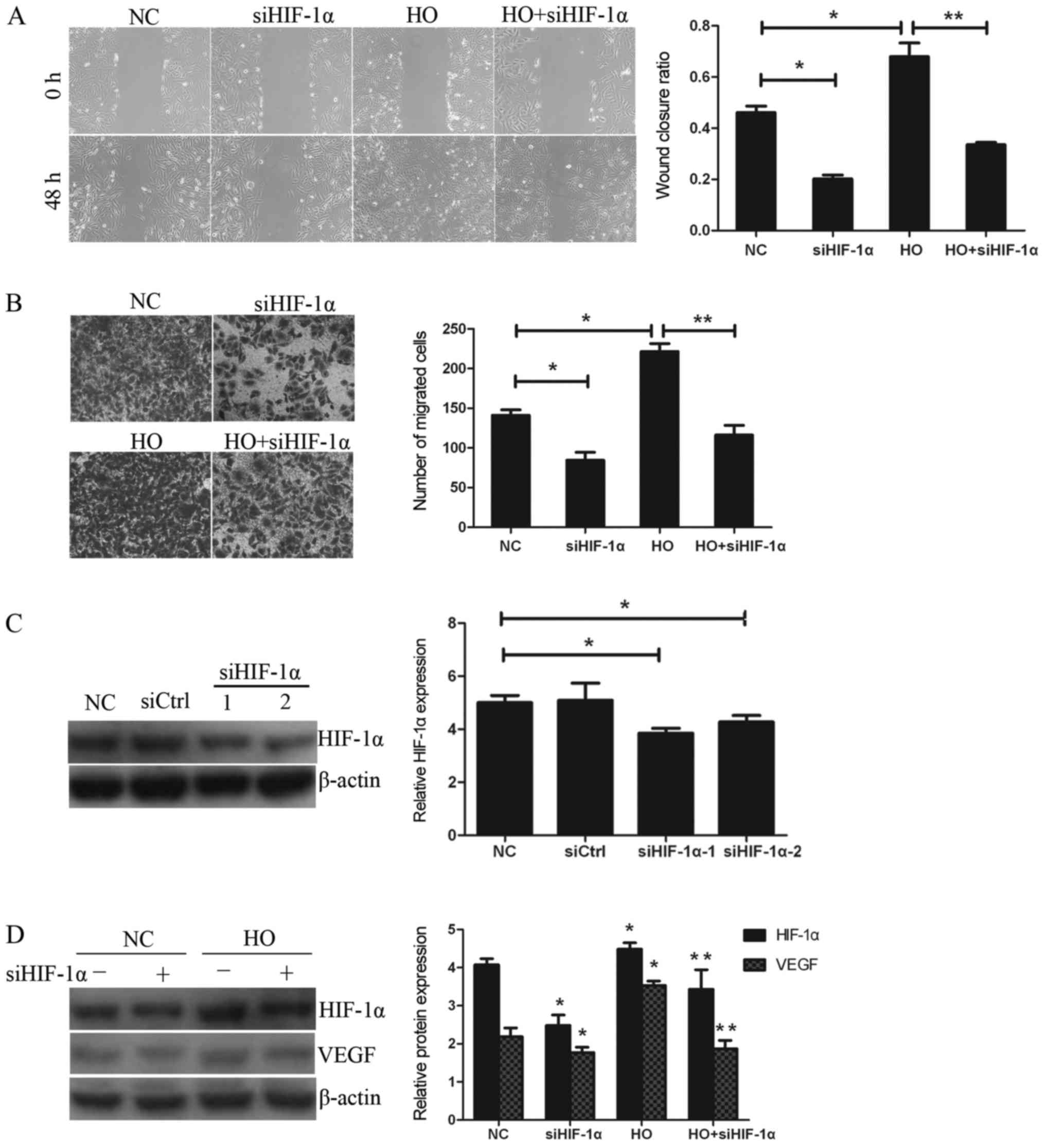 Metformin Suppresses Hypoxia Induced Migration Via The Hif 1a Vegf Pathway In Gallbladder Cancer In Vitro And In Vivo