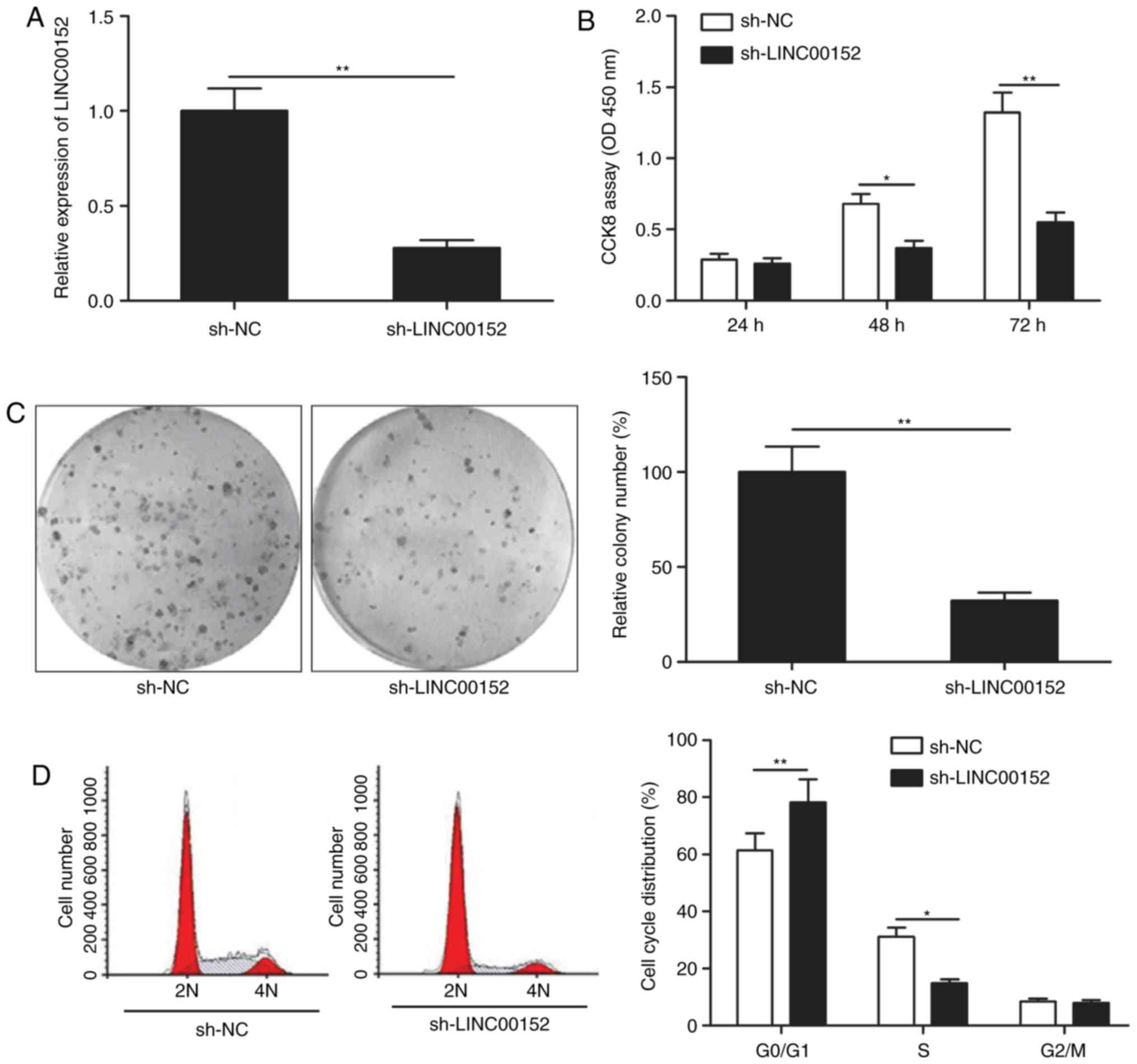 Long intergenic non‑protein coding RNA 152 promotes multiple 