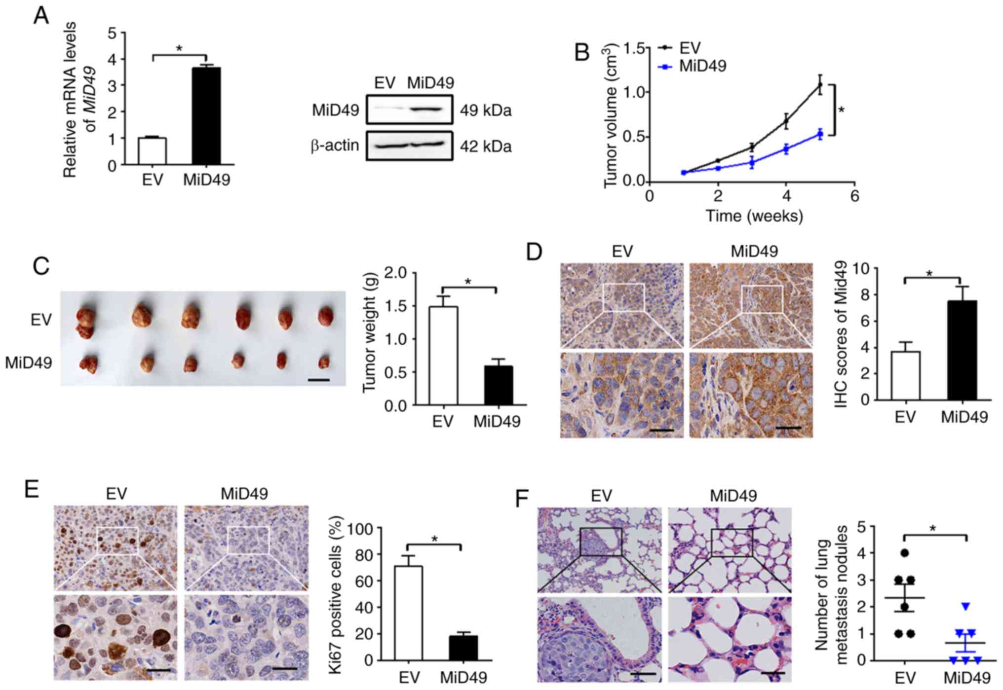 Downregulation of MiD49 contributes to tumor growth and metastasis of ...