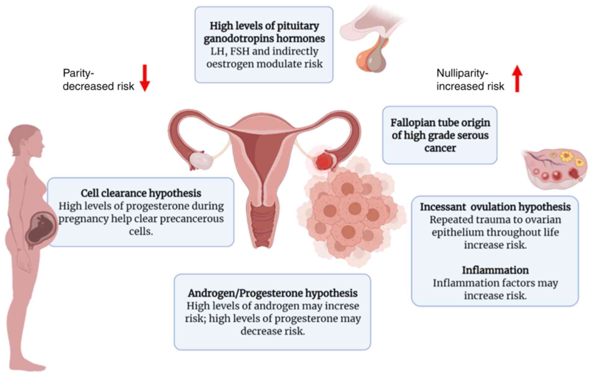 Hormone Therapy For Ovarian Cancer Emphasis On Mechanisms And 